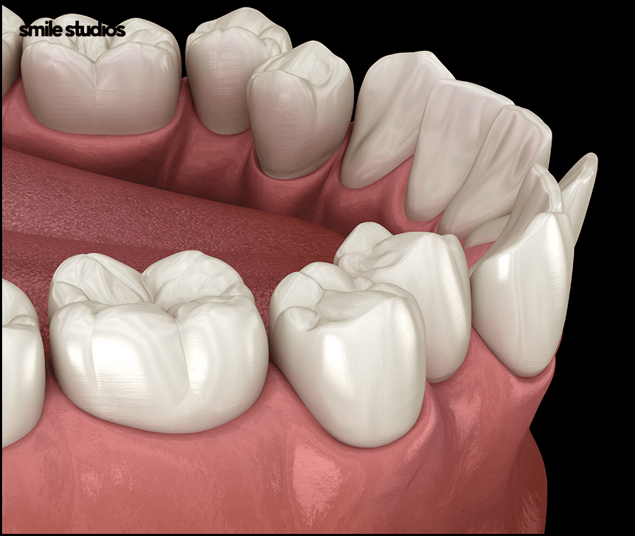 강남교정치과 선택 전 꼭 체크해야 하는 3가지 관련 이미지 2