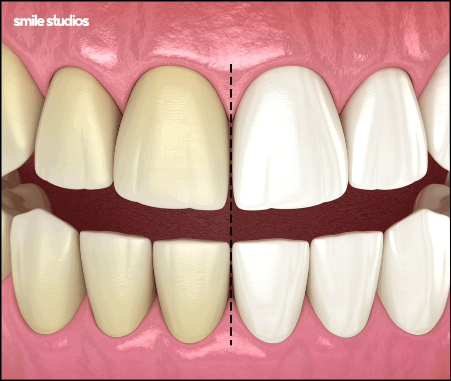 라미네이트 코팅이란? 원리와 기대 효과, 추천 대상 관련 이미지 6