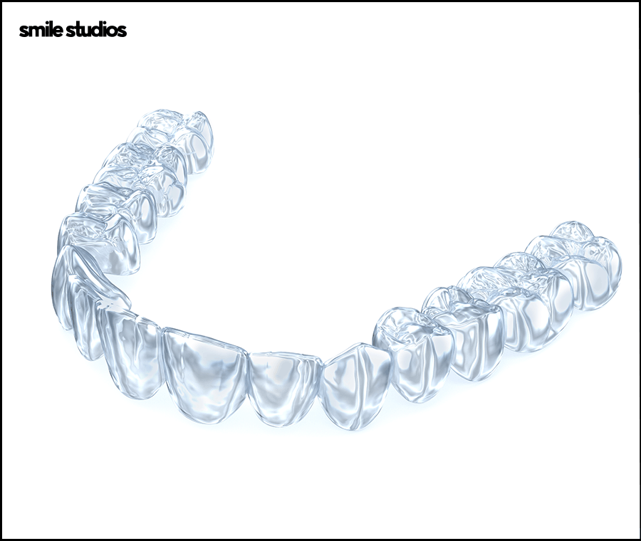 강남교정치과 선택 전 꼭 체크해야 하는 3가지 관련 이미지 7