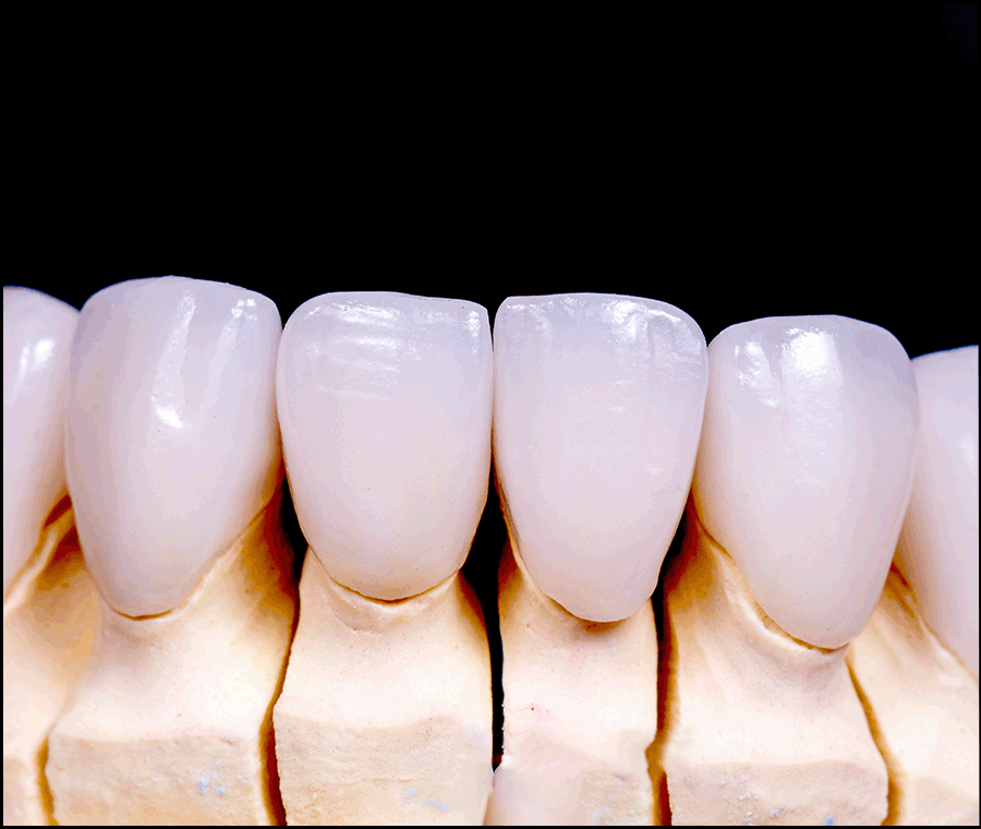 언주역치과 선택 시 꼭 확인해야 할 포인트는? 관련 이미지 8