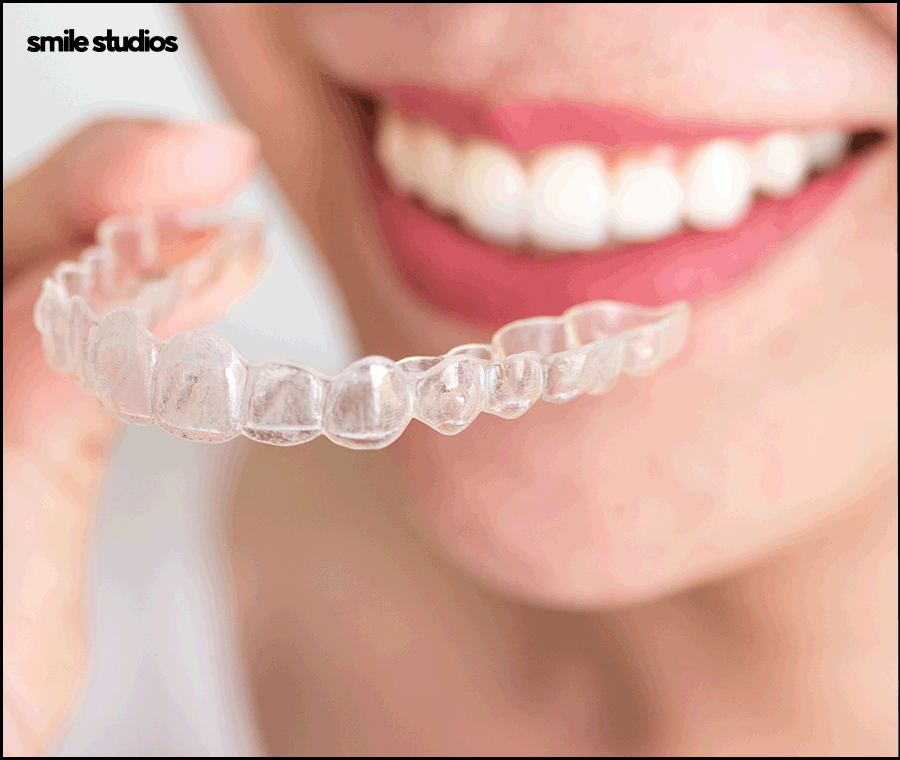 강남 인비절라인 찾는 이유, 치료 가능 범위는? 관련 이미지 9