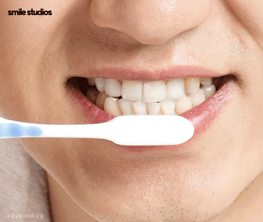 인비절라인 어태치먼트 부착 원리, 탈락 시 대처법 관련 이미지 9