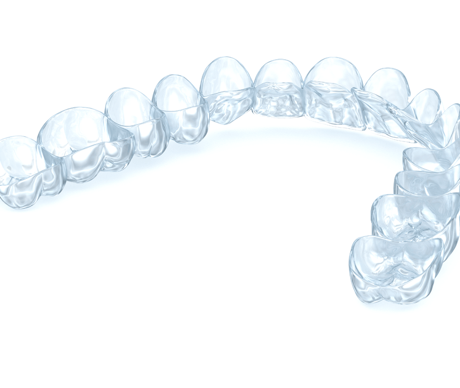 서울 논현동 치과 앞니 투명교정 장단점 총 정리 관련 이미지 6