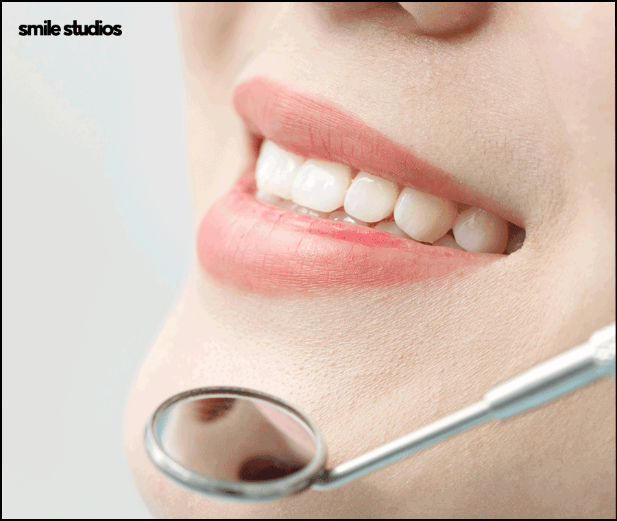 강남역 치과 라미네이트 섬세한 접근의 중요성 관련 이미지 7