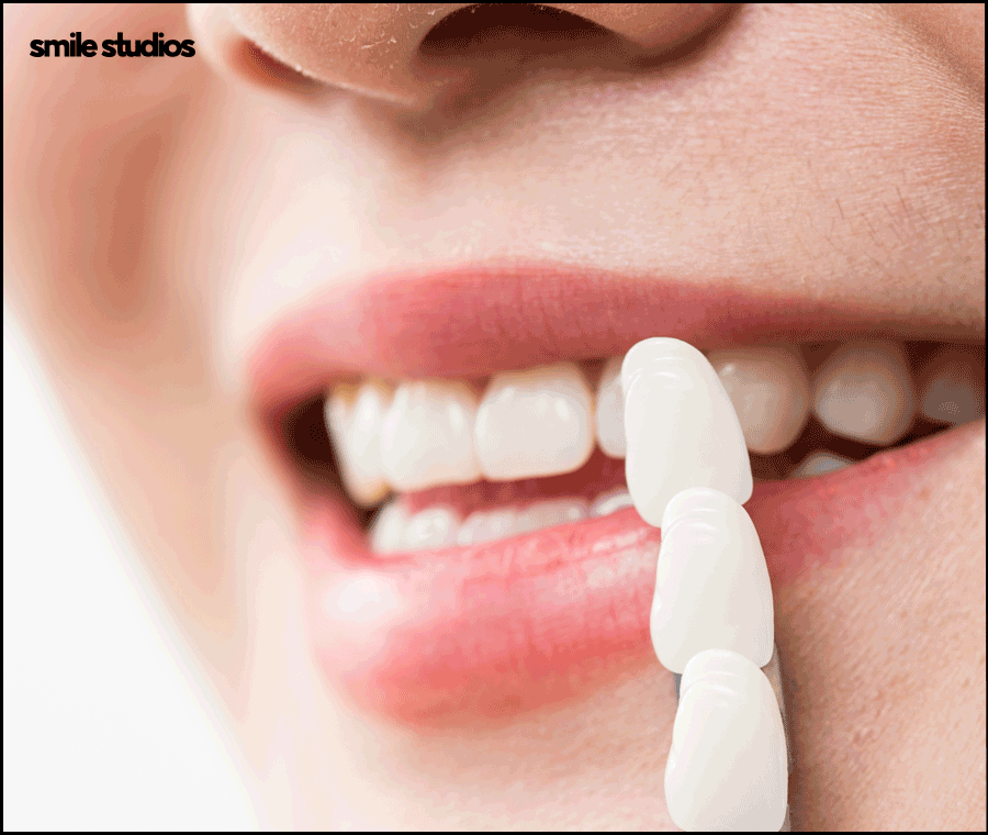 블랙트라이앵글 치료 적합한 방법 알아보기 관련 이미지 7