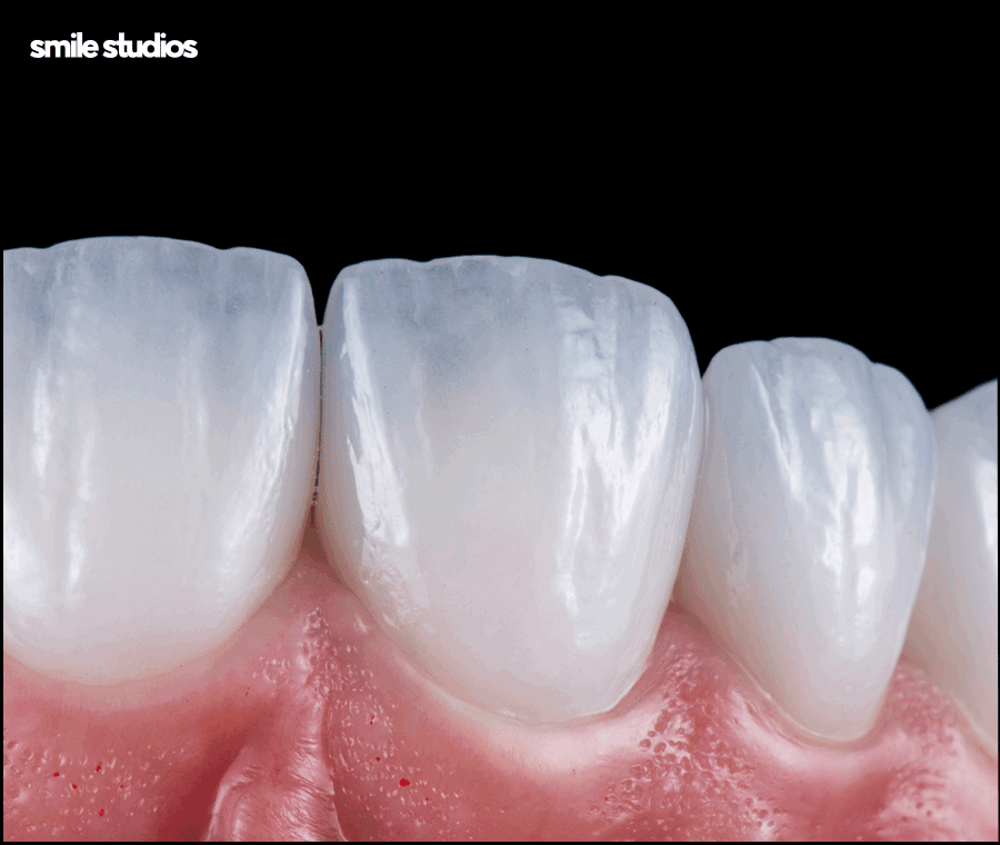 라미네이트 깨짐 대처, 어떻게 해야할까요? 방법 정리 관련 이미지 7