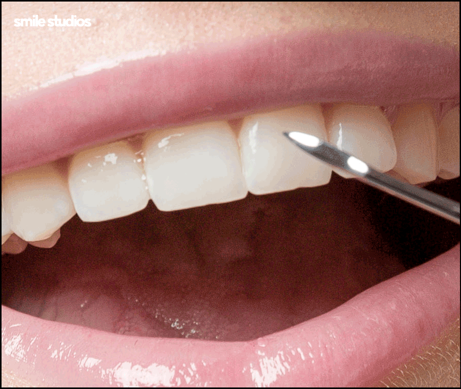 라미네이트 코팅이란? 원리와 기대 효과, 추천 대상 관련 이미지 2