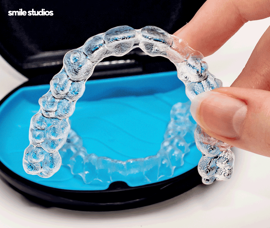 인비절라인 통증이 적은 결정적인 이유 알아보기 관련 이미지 6