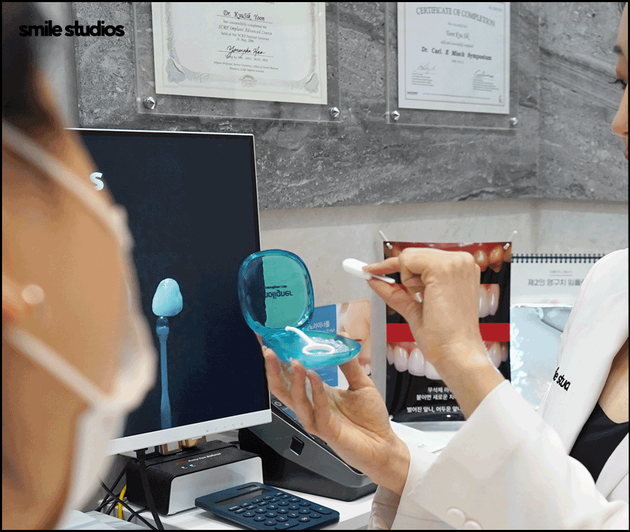 부정교합 교정기(투명) 종류 및 특징 알아보기 관련 이미지 6