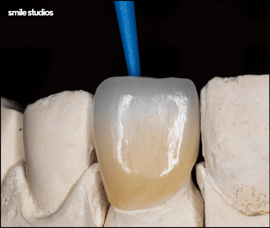 A Complete Guide to Laminate Replacement Timing, Lifespan, and Precautions image 4