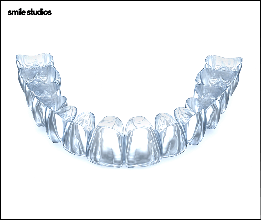 반포동 치과 돌출입 교정, 인비절라인 효과는? 관련 이미지 2