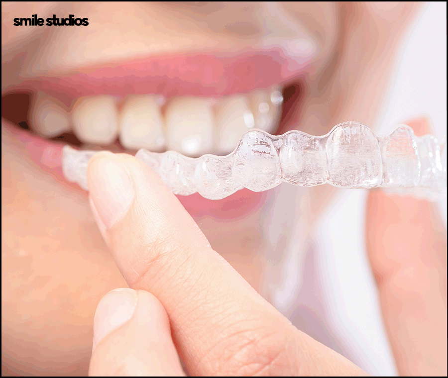 잠원동치과 치아교정 관련 이미지 9