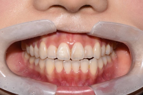 강남라미네이트 혹시 아직도 관련 이미지 3