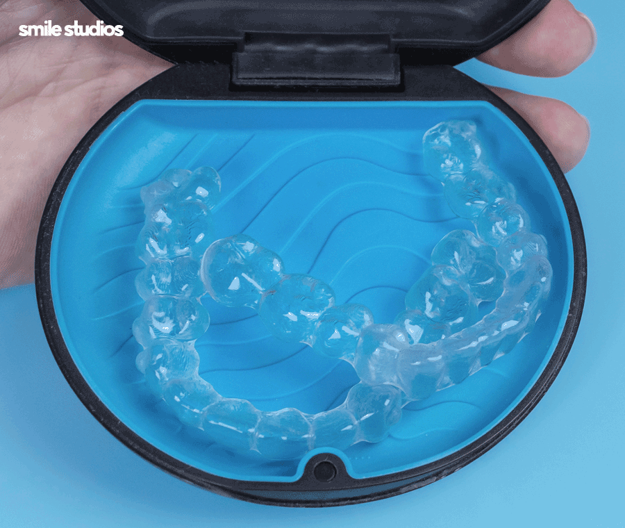 옥니 교정 필요한 이유, 발생 원인, 방법 파헤치기 관련 이미지 8