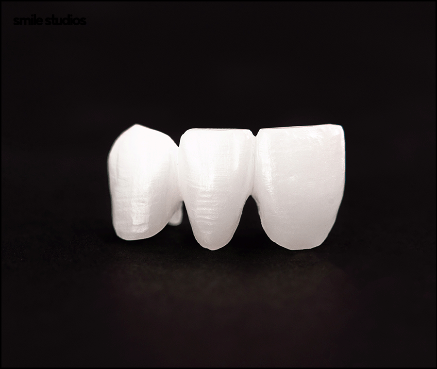 라미네이트 코팅이란? 원리와 기대 효과, 추천 대상 관련 이미지 8