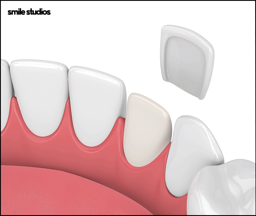 라미네이트 코팅이란? 원리와 기대 효과, 추천 대상 관련 이미지 7