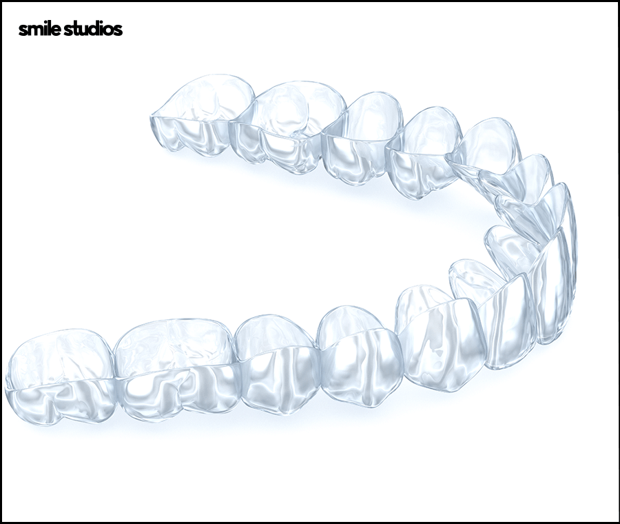 선정릉역치과 인비절라인 교정 전 필수 확인 사항 관련 이미지 3