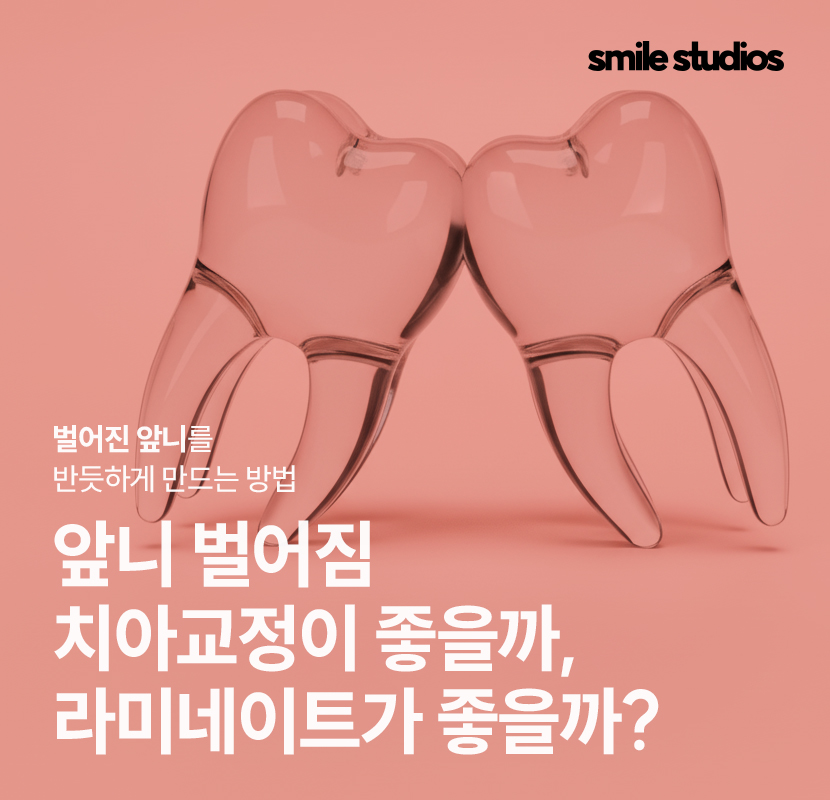 강남 신사역 치과 앞니 벌어짐 교정vs라미네이트 관련 이미지 1