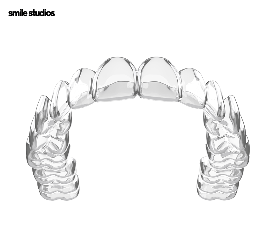 잠원동치과 투명교정 나노라이너, 인비절라인 비교 관련 이미지 3