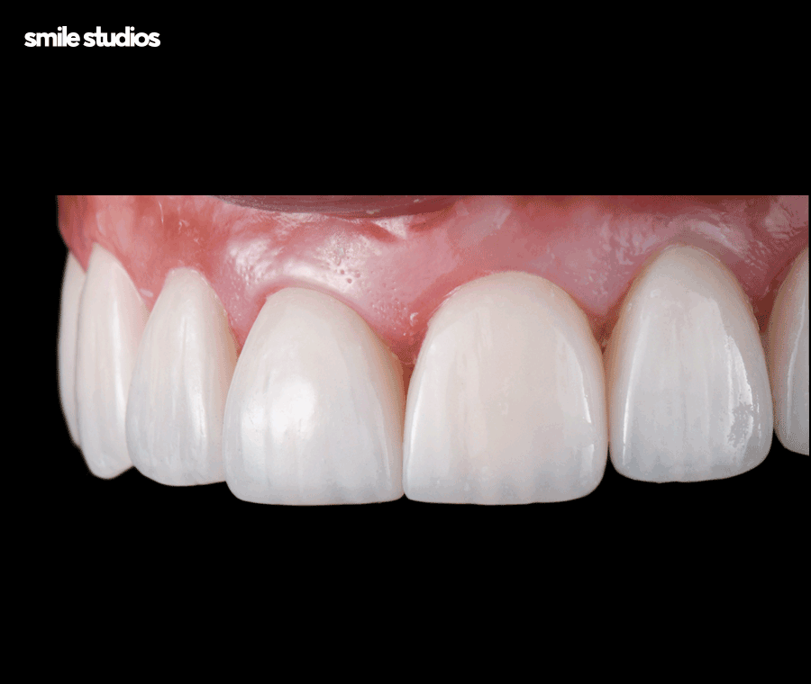 언주역치과 선택 시 꼭 확인해야 할 포인트는? 관련 이미지 2