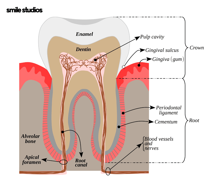 앞니깨짐 치료, 라미네이트 수복 여부, 효과 관련 이미지 3