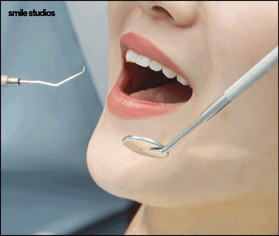 강남논현동치과 인비절라인 과정 및 개선 효과는? 관련 이미지 9