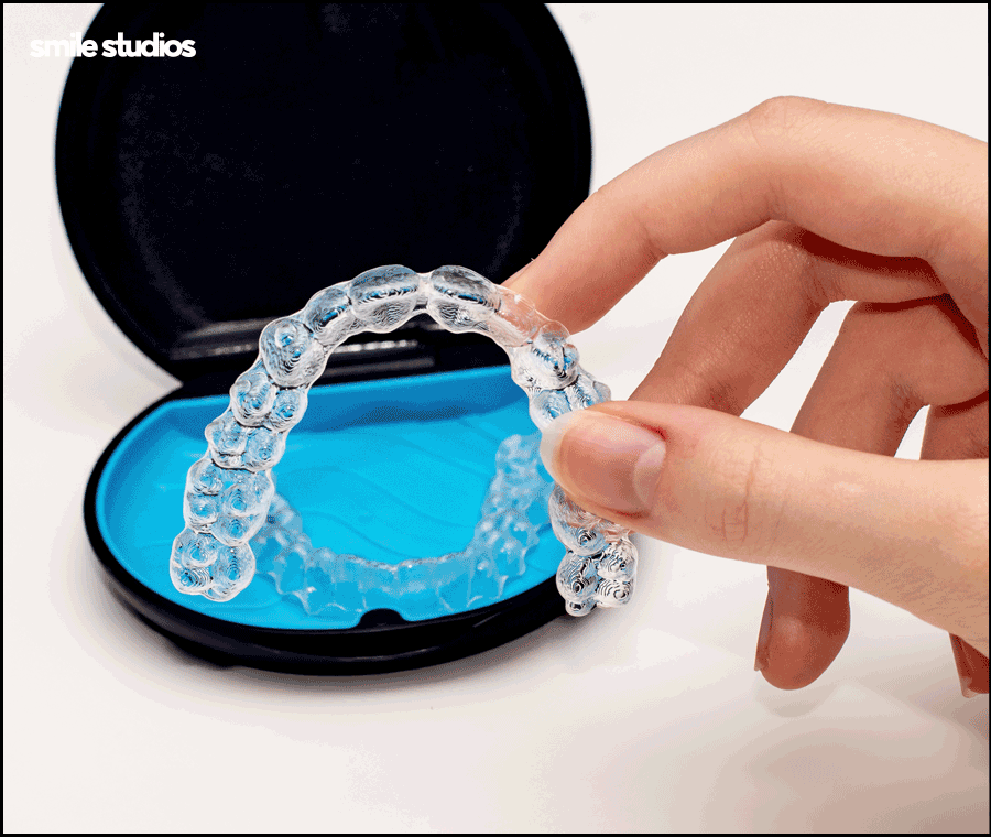 논현동 치과 인비절라인 투명교정 효과, 장/단점 관련 이미지 9