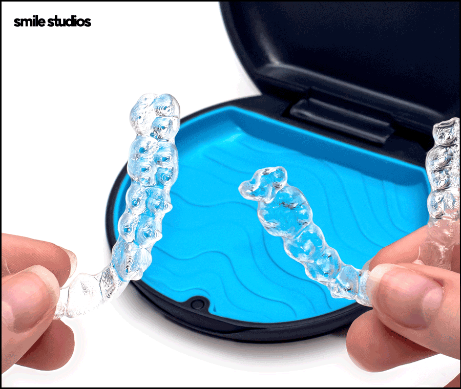 인비절라인 고무줄 착용해야 할까요? 기능 확인 관련 이미지 8