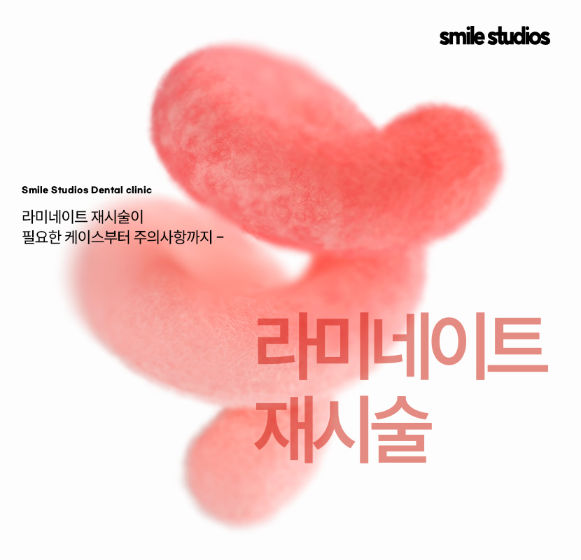 라미네이트 재시술 필요한 케이스, 주의사항 정리 관련 이미지 1