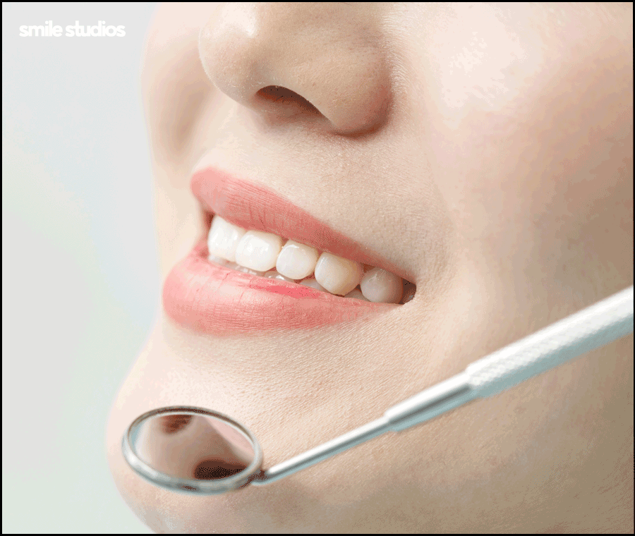 강남무삭제라미네이트 시작 전 확인할 핵심 포인트 관련 이미지 4