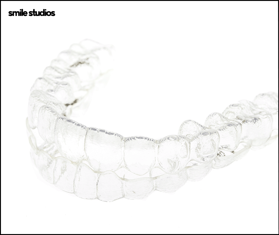 선정릉역치과 인비절라인 교정 전 필수 확인 사항 관련 이미지 7