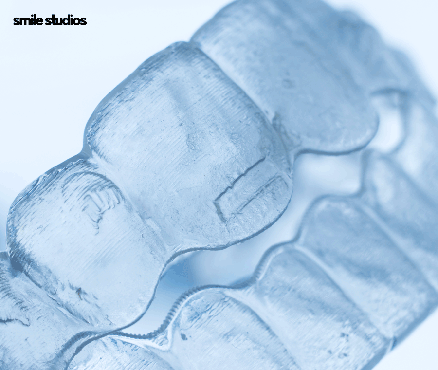 압구정 교정치과 인비절라인, 나노라이너 선택 기준 관련 이미지 8