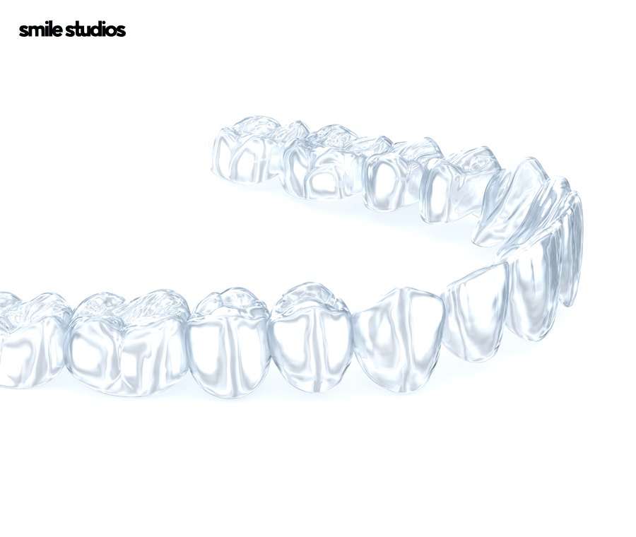 투명 교정기 세척 올바른 관리 방법 A to Z 관련 이미지 2