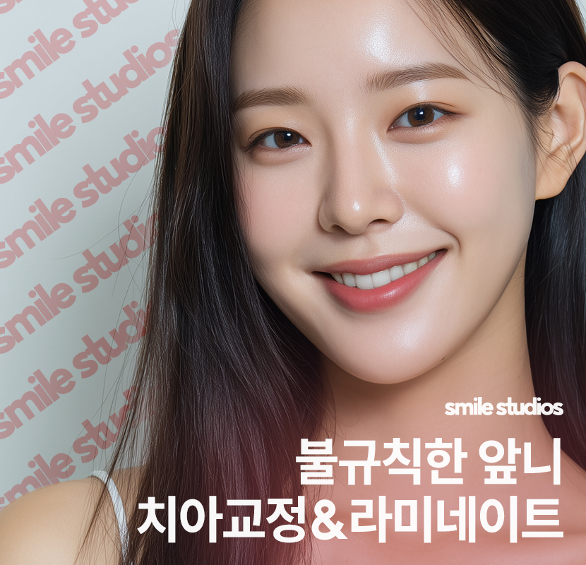 논현동 치과 불규칙한 앞니, 교정 vs 라미네이트 관련 이미지 1
