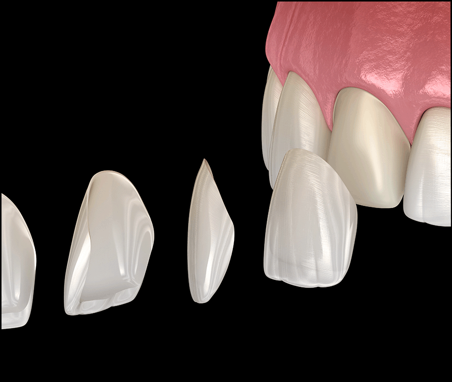 언주역치과 선택 시 꼭 확인해야 할 포인트는? 관련 이미지 9