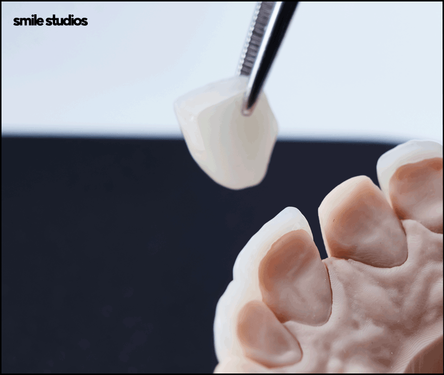 블랙트라이앵글 치료 적합한 방법 알아보기 관련 이미지 8