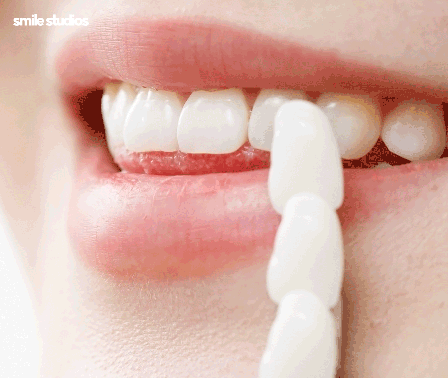 라미네이트가격 및 달라지는 기준, 확인하기 관련 이미지 7