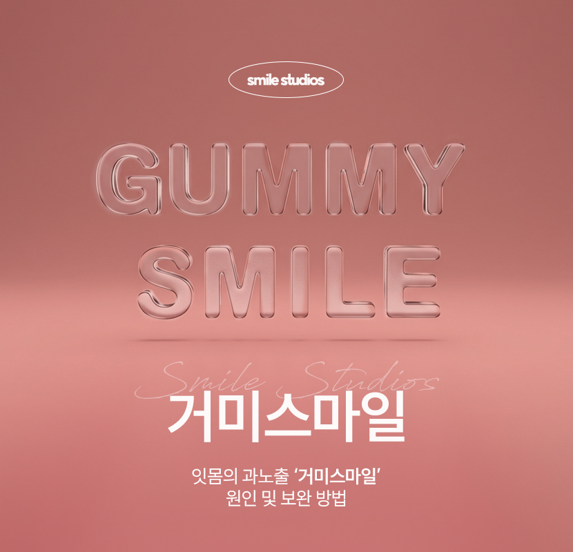 거미스마일 앞니 잇몸 과노출, 원인 및 보완 방법 관련 이미지 1