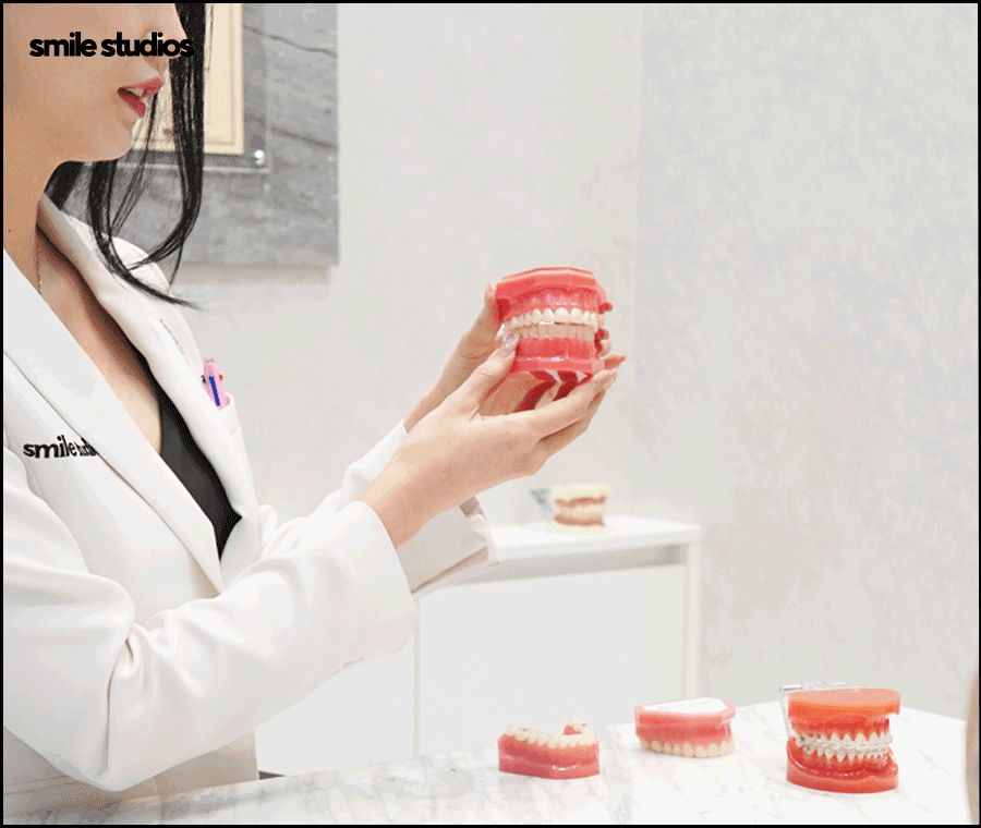 인비절라인 유지장치 착용 기간, 주의사항 알아보기 관련 이미지 5