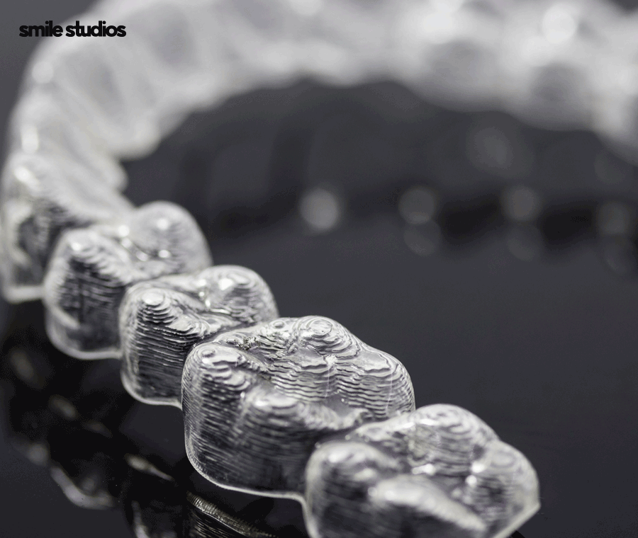 투명교정후기 알아본다면 함께 꼭 확인해야 할 2가지 관련 이미지 7