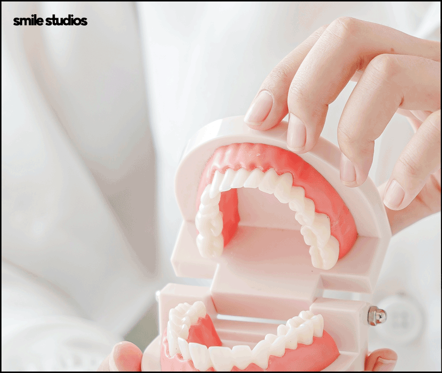 왜소치라미네이트 심미성 개선 효과, 필요성 관련 이미지 7