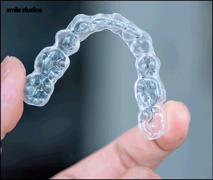 Invisalign Cost, Treatment Duration, and Pre-Treatment Checklist image 2