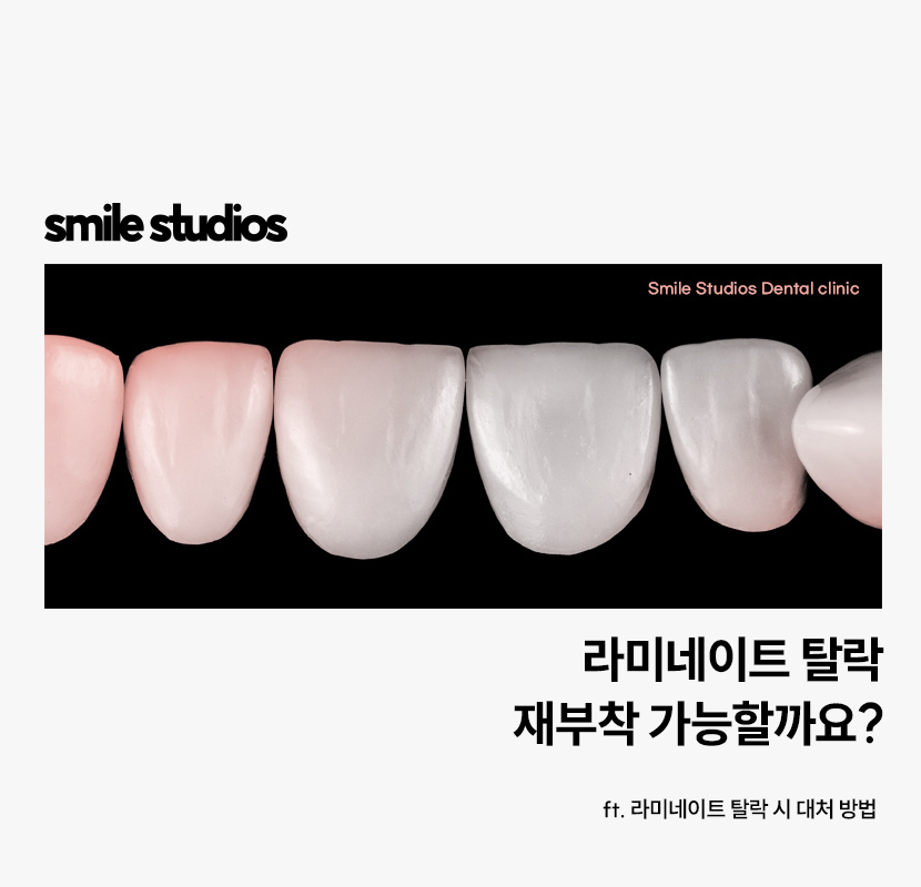 라미네이트 빠짐, 재부착 가능할까요? +대처방법 관련 이미지 1