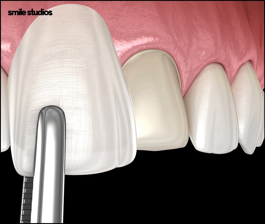 언주역치과 선택 시 꼭 확인해야 할 포인트는? 관련 이미지 5