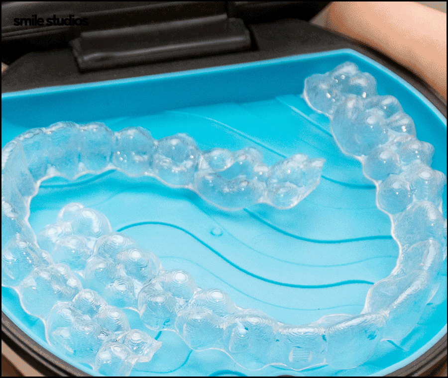 돌출입 인비절라인 기간, 과정, 개선 효과 관련 이미지 4