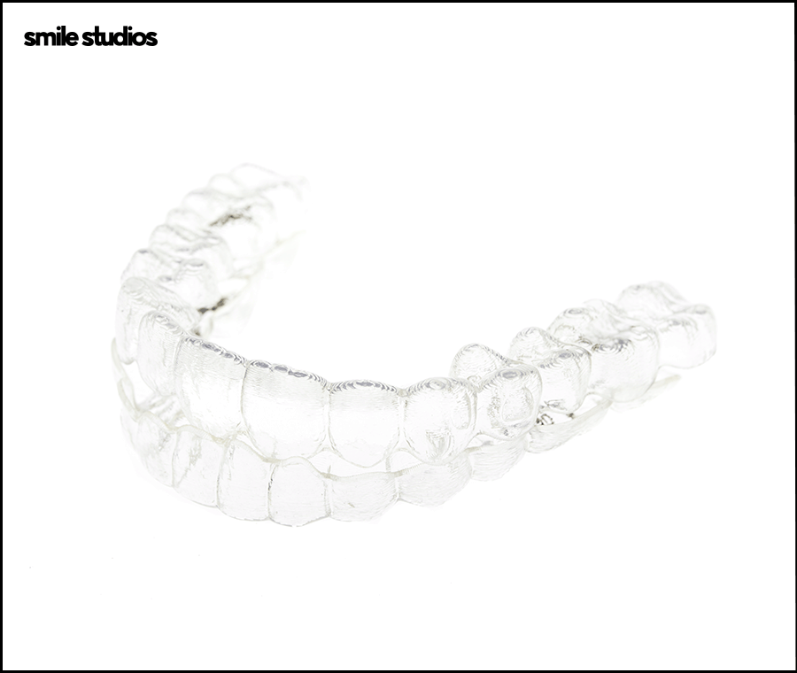 인비절라인 고무줄 착용해야 할까요? 기능 확인 관련 이미지 5