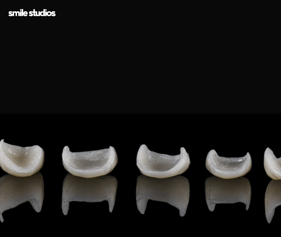 라미네이트가격 및 달라지는 기준, 확인하기 관련 이미지 4