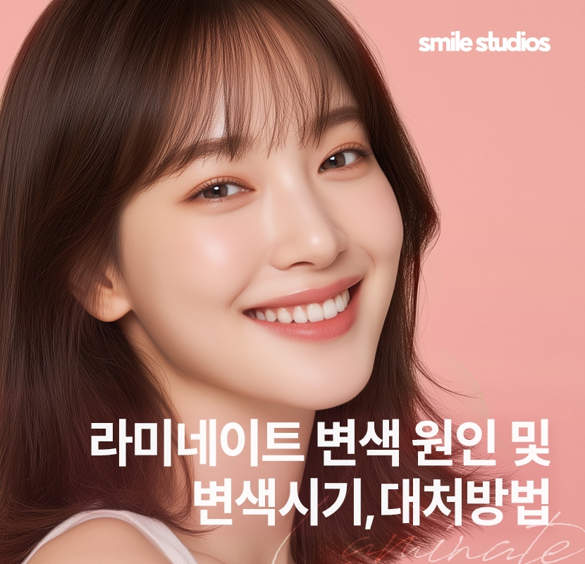 라미네이트 변색, 발생하는 이유, 시점, 대처 방법 관련 이미지 1