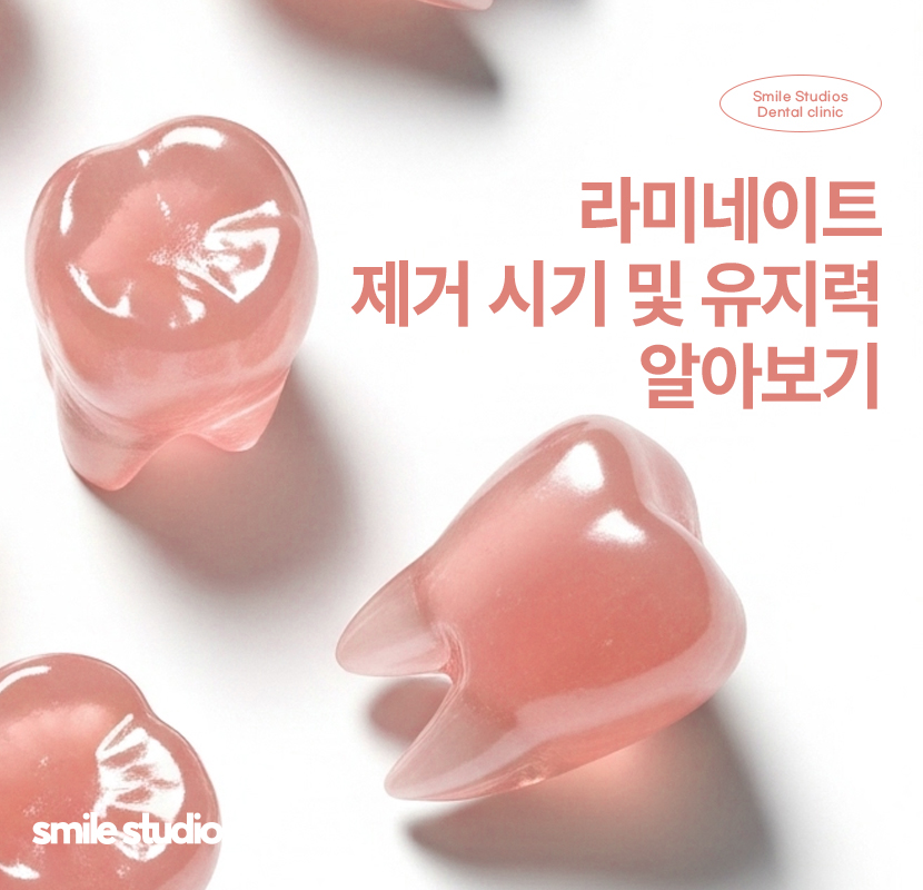 라미네이트제거 시기 및 유지력, 알아둘 사항 관련 이미지 1