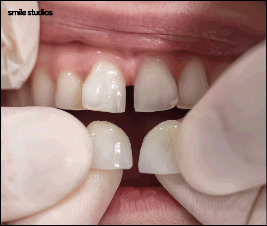 강남라미네이트 기대 효과, 원리, 유지기간 관련 이미지 10